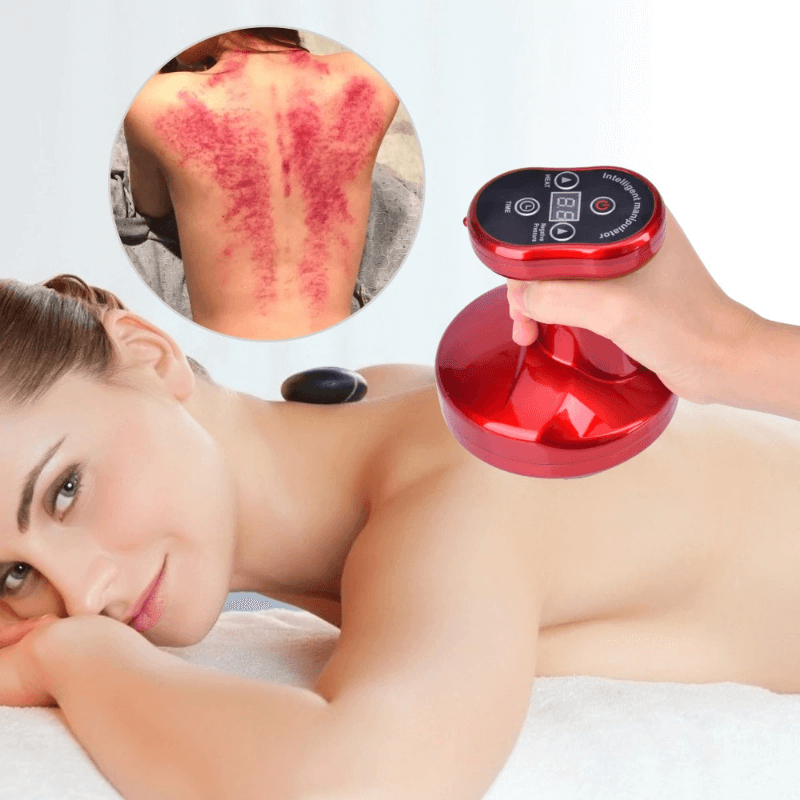 Elektrisches Schröpfen Akupunktur Körper Massagegerät